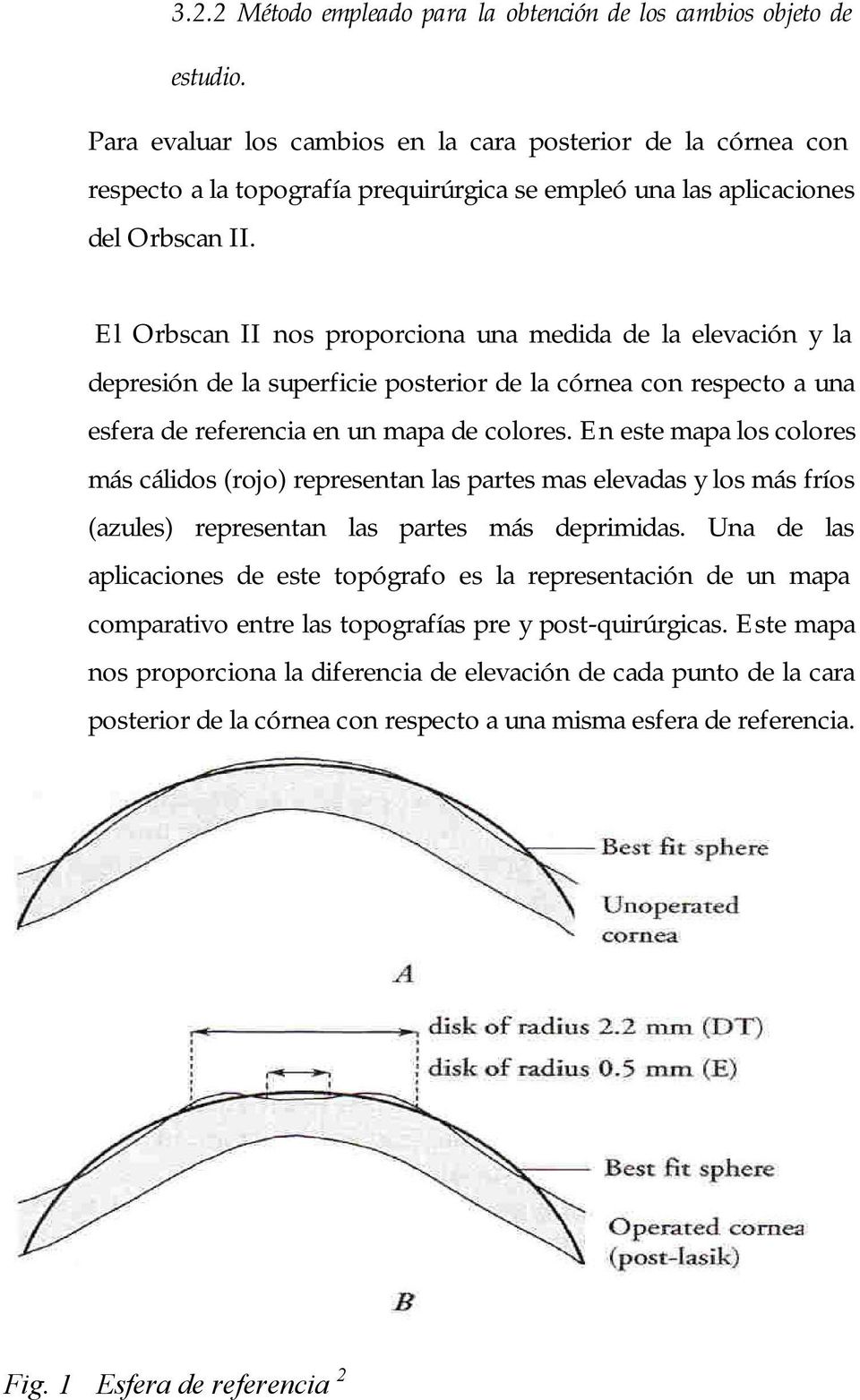 El Orbscan II nos proporciona una medida de la elevación y la depresión de la superficie posterior de la córnea con respecto a una esfera de referencia en un mapa de colores.