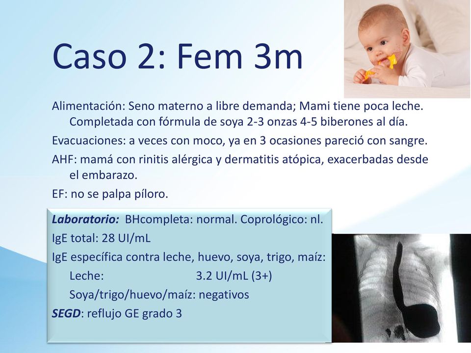 AHF: mamá con rinitis alérgica y dermatitis atópica, exacerbadas desde el embarazo. EF: no se palpa píloro.