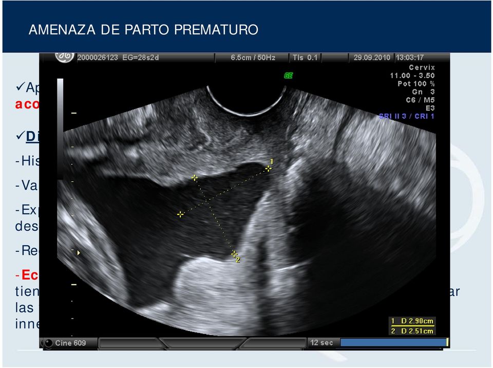 descartar RPM, toma de muestras para cultivos -Registro cardiotocográfico para valoración de dinámica uterina -Ecografía transvaginal para