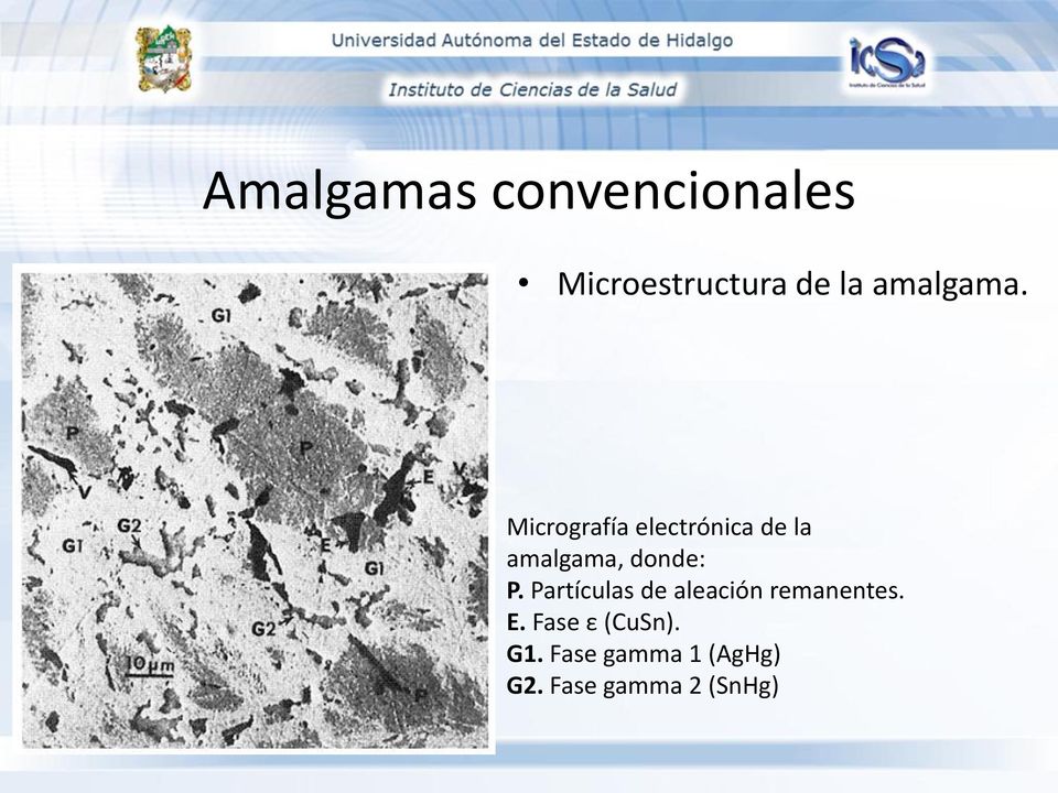 Micrografía electrónica de la amalgama, donde: P.