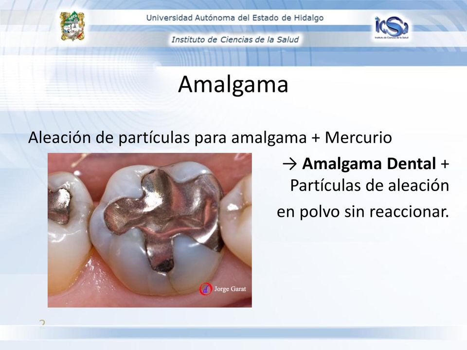Mercurio Amalgama Dental +