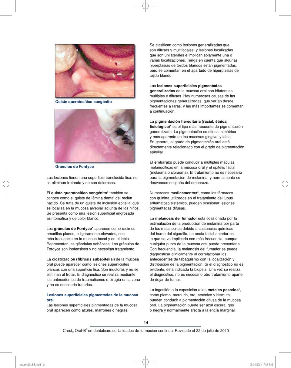 Quiste queratocítico congénito Las lesiones superficiales pigmentadas generalizadas de la mucosa oral son bilaterales, múltiples y difusas.