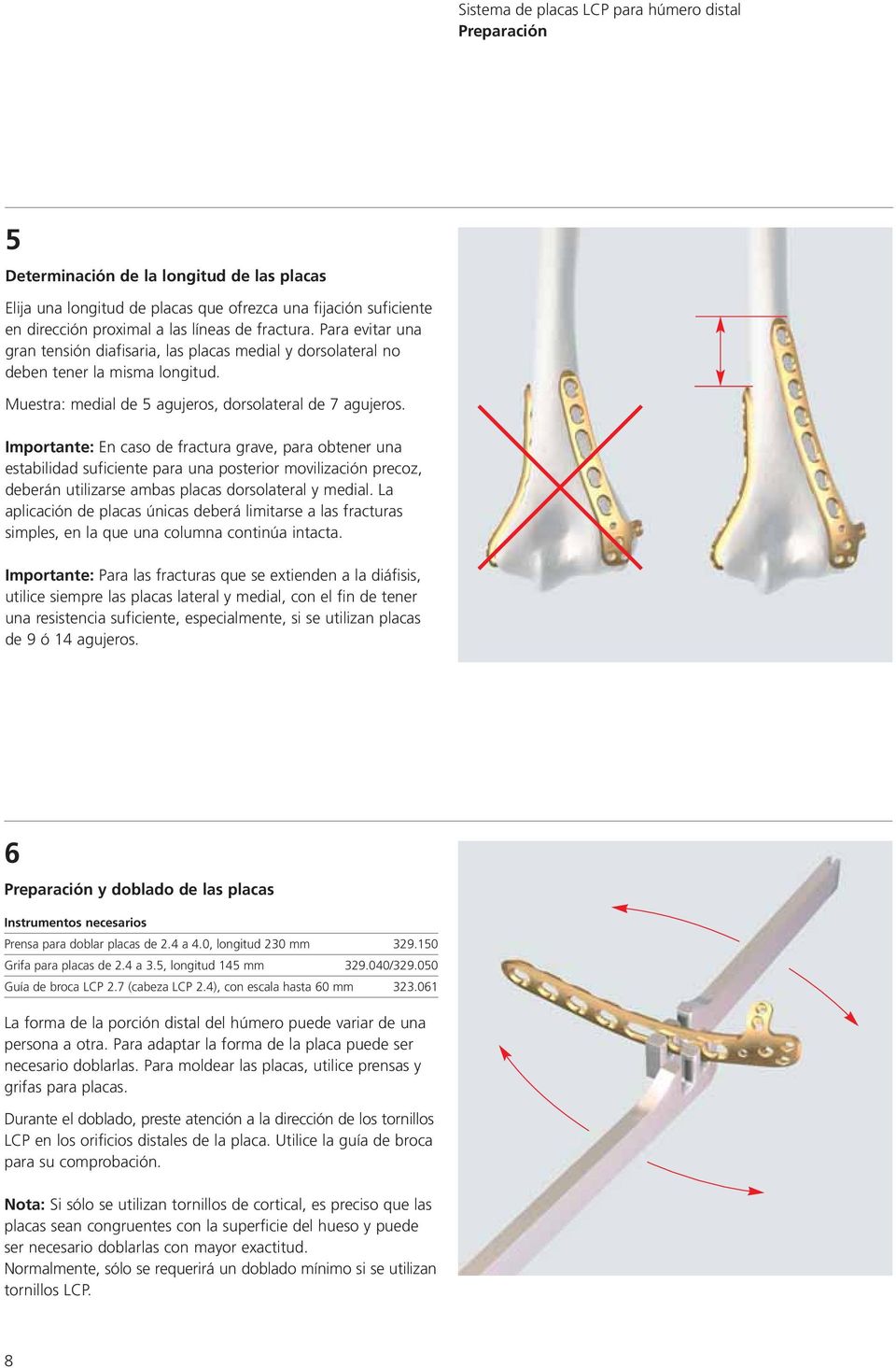 Importante: En caso de fractura grave, para obtener una estabilidad suficiente para una posterior movilización precoz, deberán utilizarse ambas placas dorsolateral y medial.