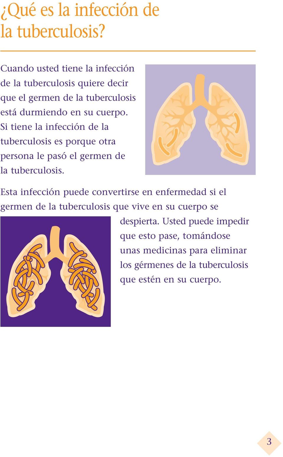 Si tiene la infección de la tuberculosis es porque otra persona le pasó el germen de la tuberculosis.