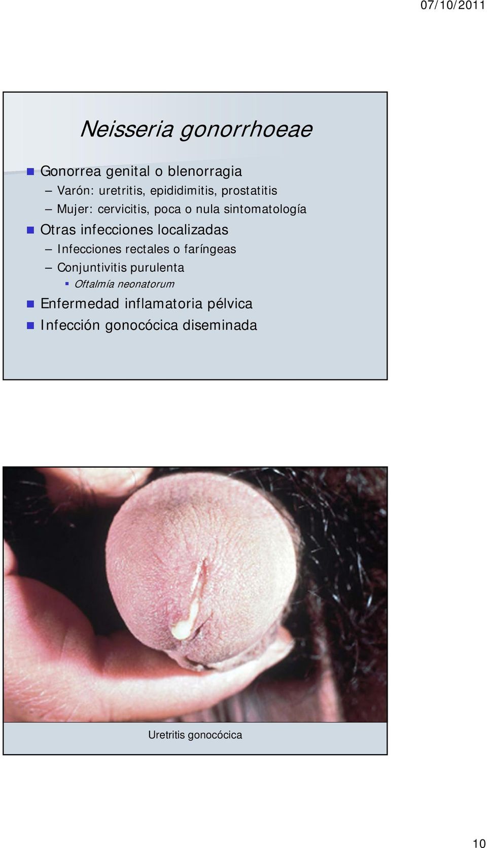 localizadas Infecciones rectales o faríngeas Conjuntivitis purulenta Oftalmía
