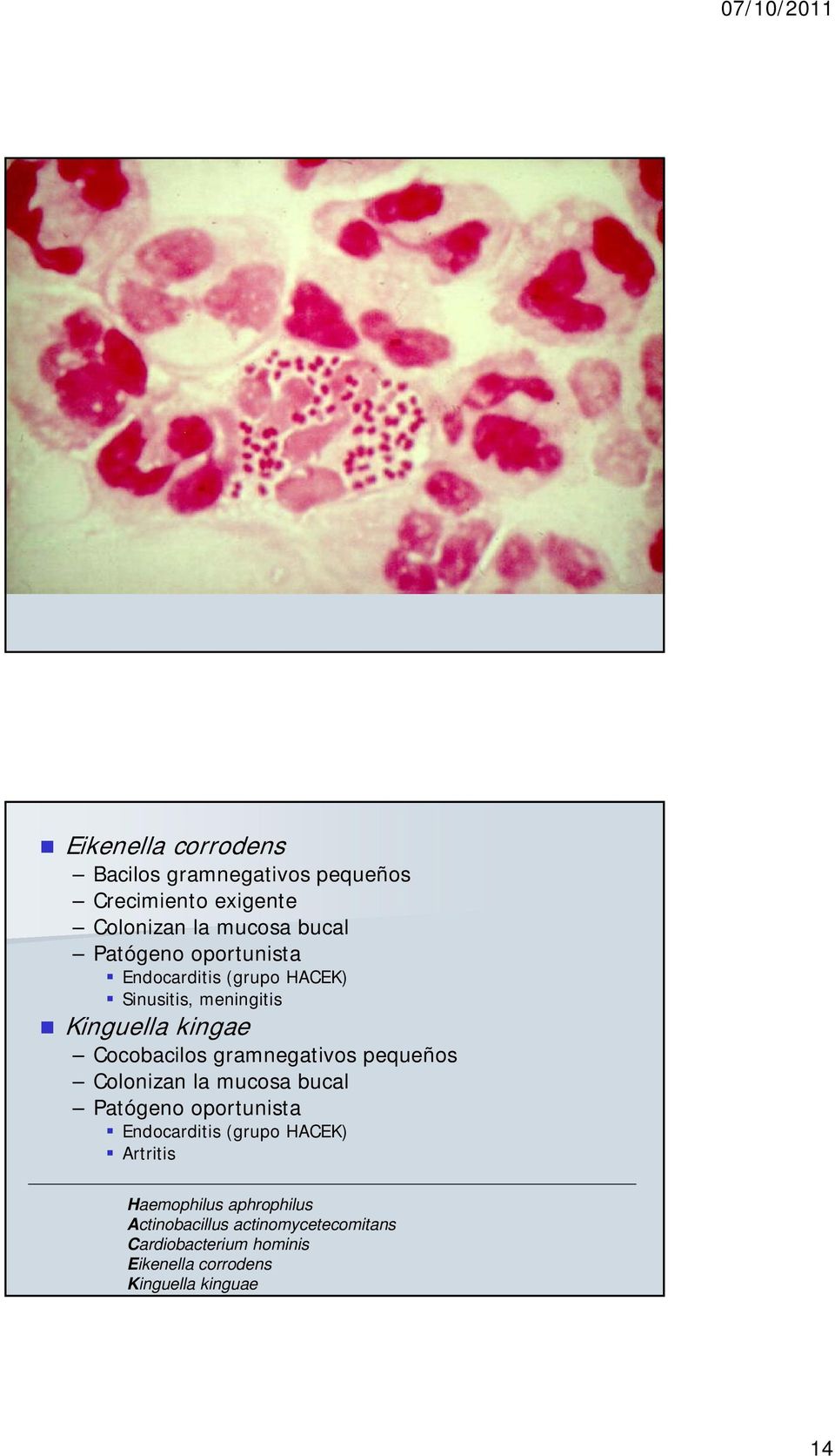 pequeños Colonizan la mucosa bucal Patógeno oportunista Endocarditis (grupo HACEK) Artritis Haemophilus