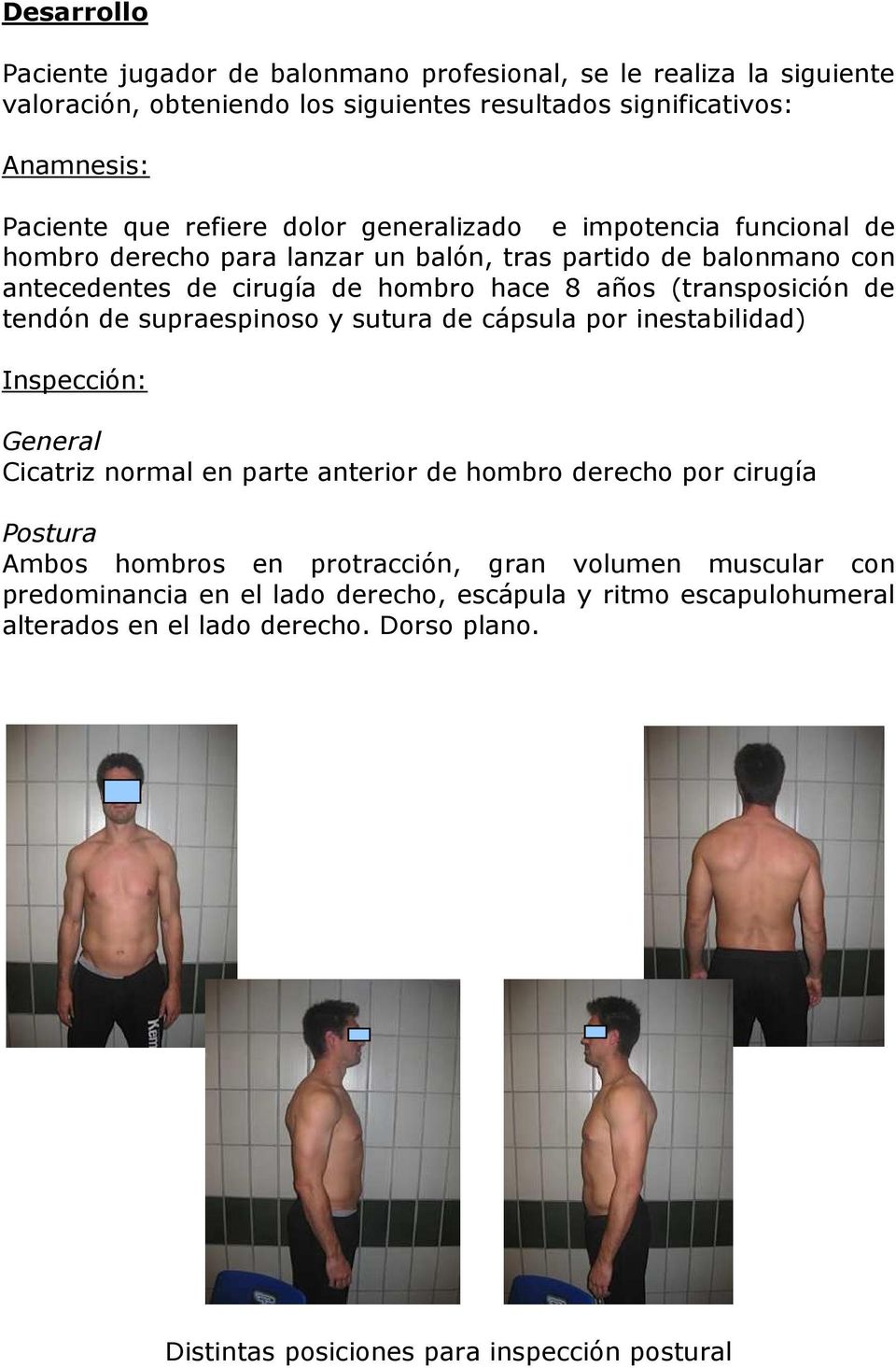 tendón de supraespinoso y sutura de cápsula por inestabilidad) Inspección: General Cicatriz normal en parte anterior de hombro derecho por cirugía Postura Ambos hombros en