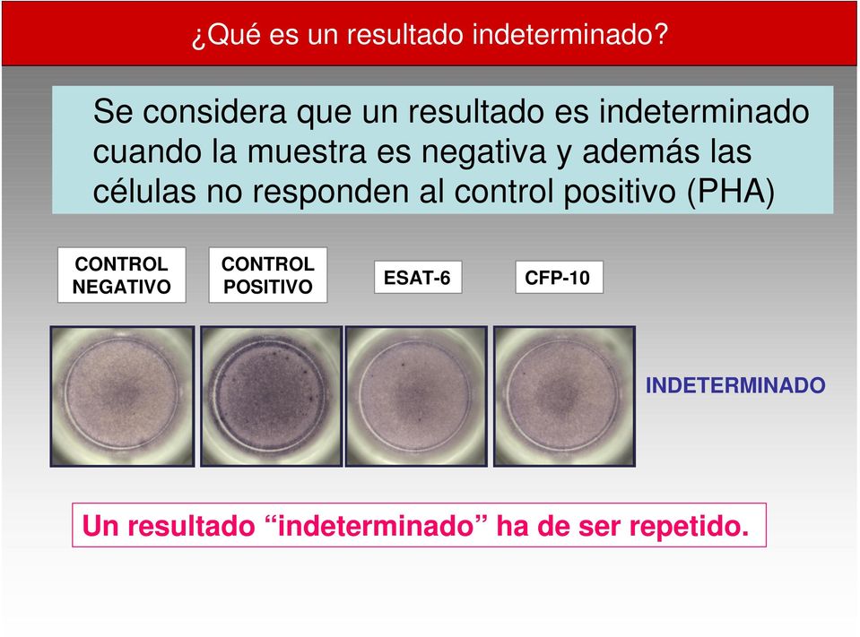 negativa y además las células no responden al control positivo (PHA)