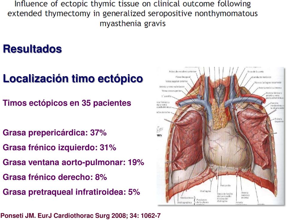 Grasa ventana aorto-pulmonar: 19% Grasa frénico derecho: 8% Grasa