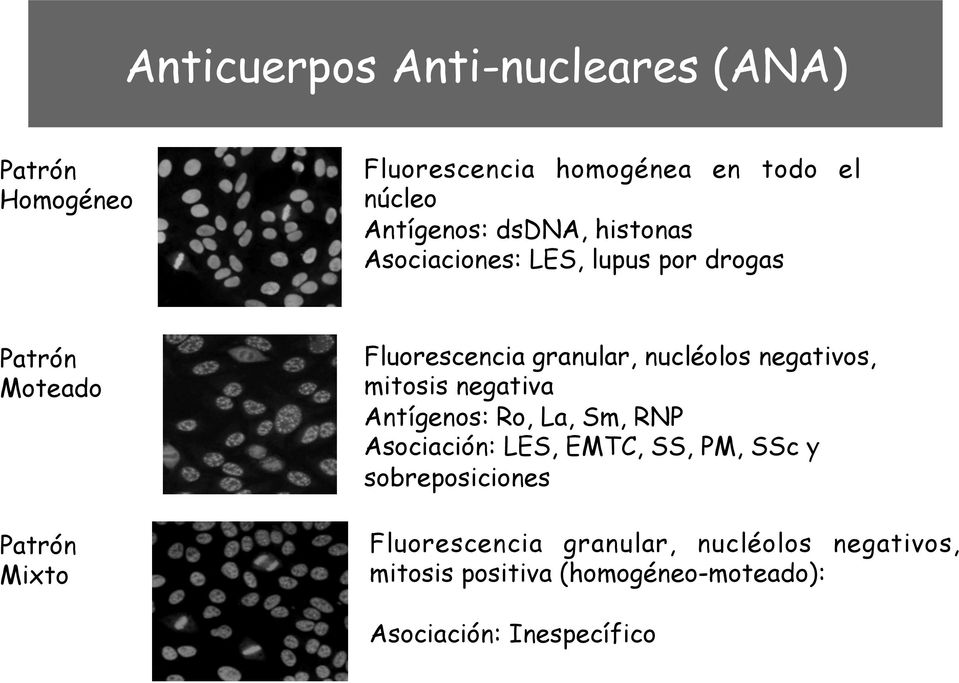 nucléolos negativos, mitosis negativa Antígenos: Ro, La, Sm, RNP Asociación: LES, EMTC, SS, PM, SSc y