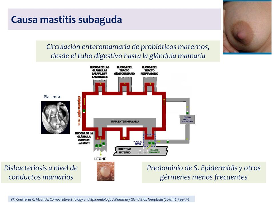mamarios Predominio de S. Epidermidis y otros gérmenes menos frecuentes (*) Contreras G.