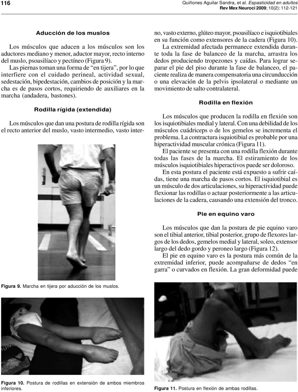 Las piernas toman una forma de en tijera, por lo que interfiere con el cuidado perineal, actividad sexual, sedestación, bipedestación, cambios de posición y la marcha es de pasos cortos, requiriendo