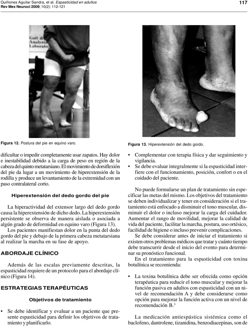 El movimiento de dorsiflexión del pie da lugar a un movimiento de hiperextensión de la rodilla y produce un levantamiento de la extremidad con un paso contralateral corto.