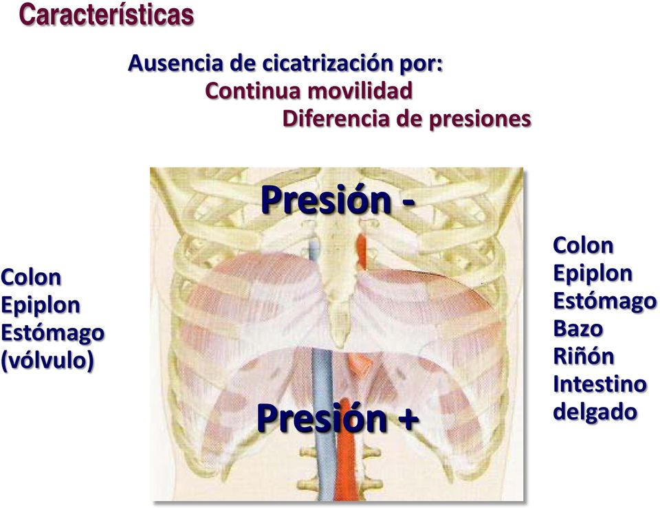Epiplon Estómago (vólvulo) Presión - Presión +