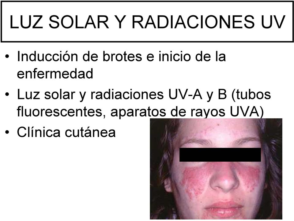 solar y radiaciones UV-A y B (tubos