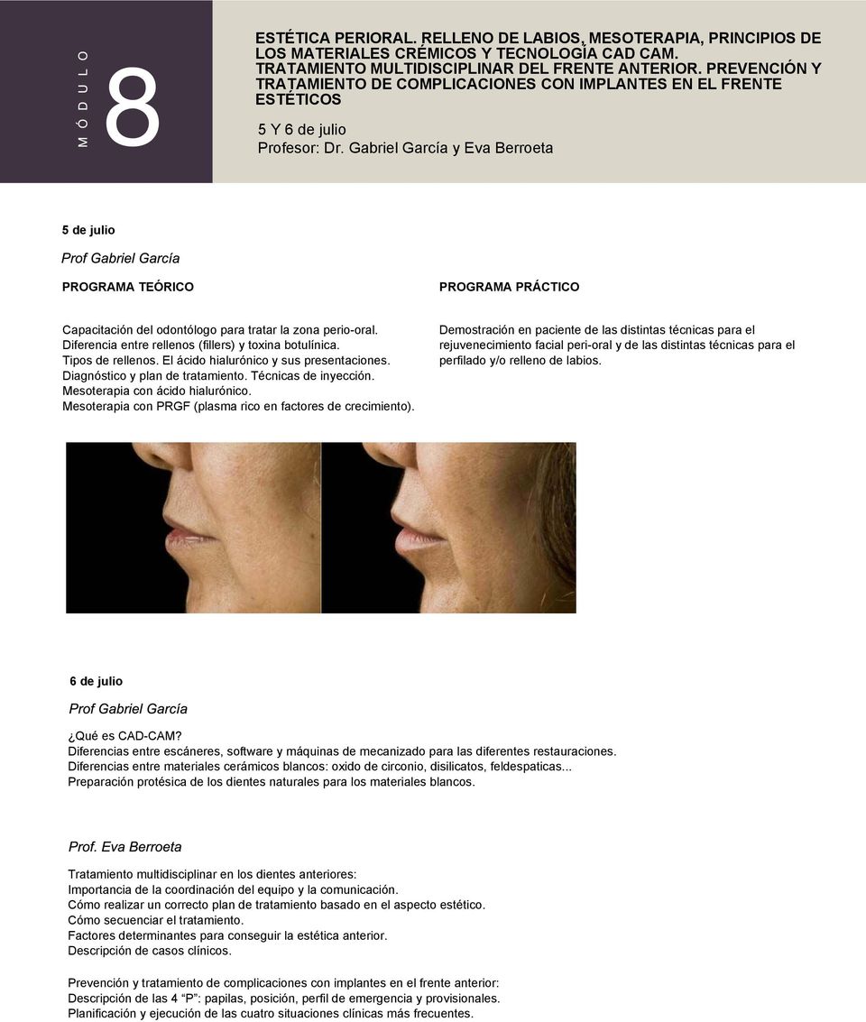 Gabriel García y Eva Berroeta 5 de julio PROGRAMA TEÓRICO PROGRAMA PRÁCTICO Capacitación del odontólogo para tratar la zona perio-oral. Diferencia entre rellenos (fillers) y toxina botulínica.