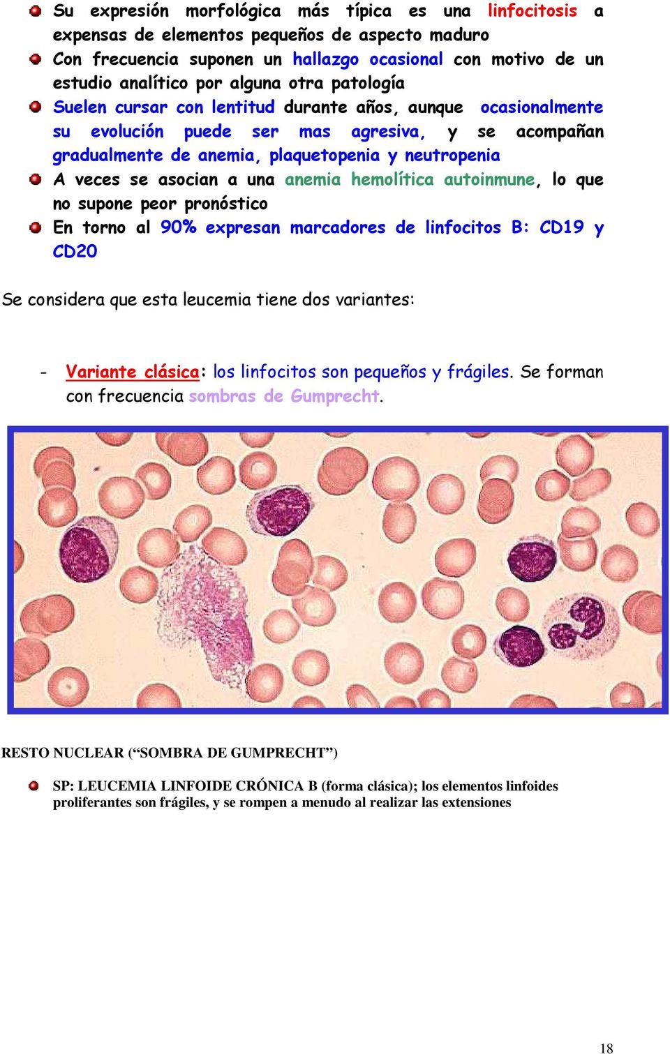 asocian a una anemia hemolítica autoinmune, lo que no supone peor pronóstico En torno al 90% expresan marcadores de linfocitos B: CD19 y CD20 Se considera que esta leucemia tiene dos variantes: -