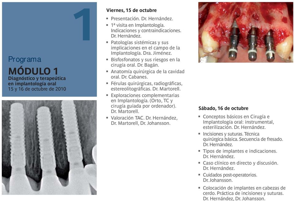 Anatomía quirúrgica de la cavidad oral. Dr. Cabanes. Férulas quirúrgicas, radiográficas, estereolitográficas. Dr. Martorell. Exploraciones complementarias en Implantología.