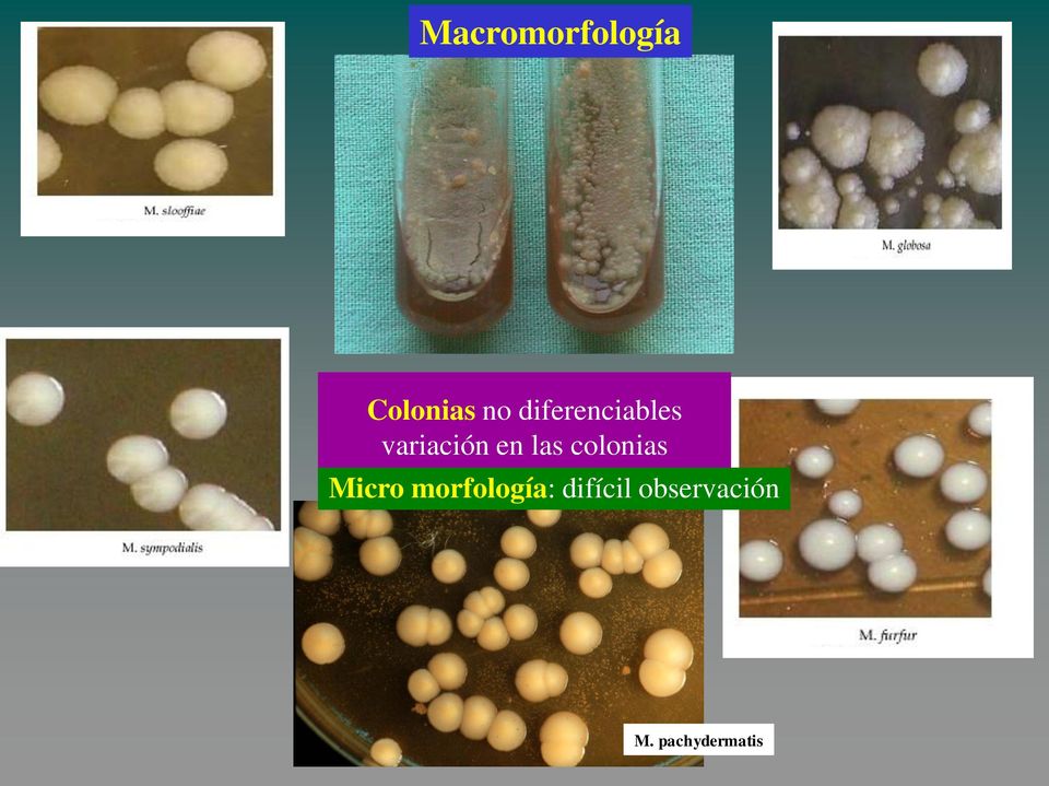 las colonias Micro morfología: