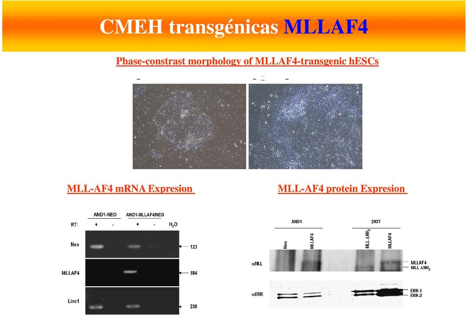 MLLAF4-transgenic hescs MLL-AF4