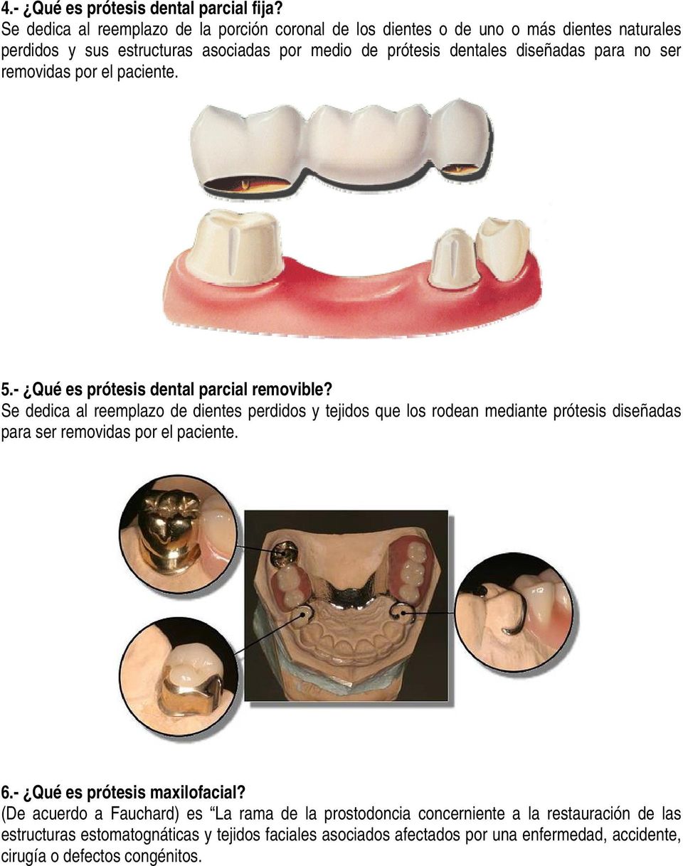 para no ser removidas por el paciente. 5.- Qué es prótesis dental parcial removible?