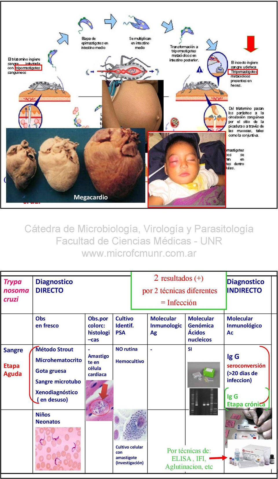 por colorc: histologi cas Amastigo te en célula cardiaca Cultivo Identif.
