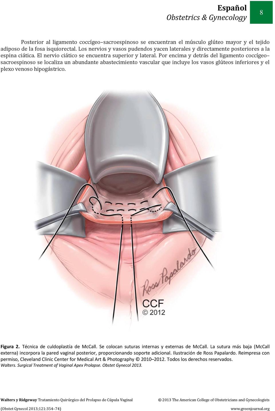 Por encima y detrás del ligamento coccígeo sacroespinoso se localiza un abundante abastecimiento vascular que incluye los vasos glúteos inferiores y el plexo venoso hipogástrico. Figura 2.