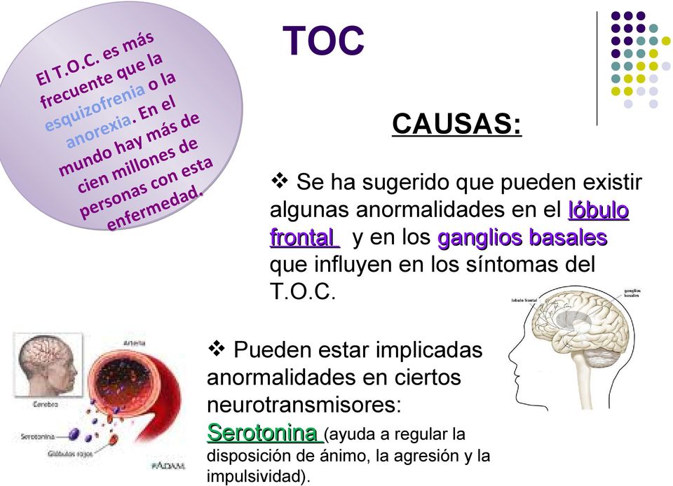 s o m ed r e p er enf TOC CAUSAS: Se ha sugerido que pueden existir algunas anormalidades en el lóbulo frontal y en