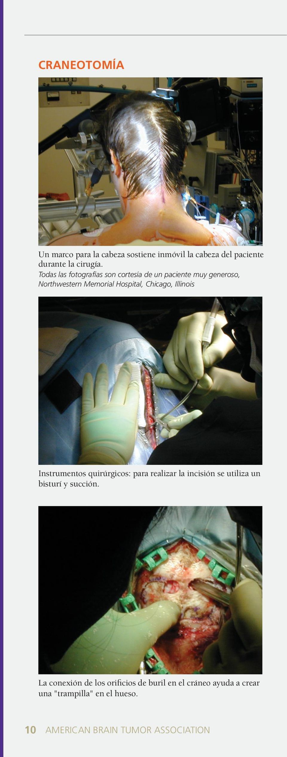 Illinois Instrumentos quirúrgicos: para realizar la incisión se utiliza un bisturí y succión.