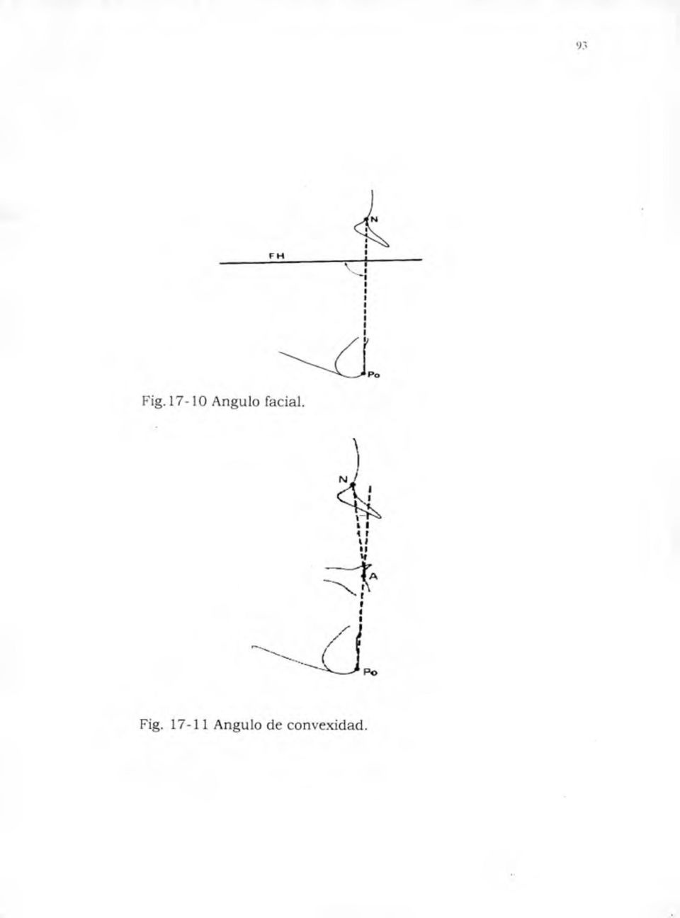 Fig. 17-11