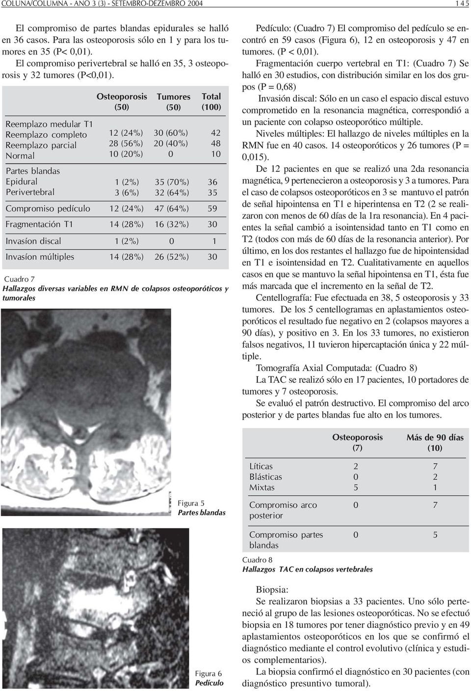 Reemplazo medular T Reemplazo completo Reemplazo parcial Normal Partes blandas Epidural Perivertebral (5) (4%) 8 (56%) (%) (%) 3 (6%) (5) 3 (6%) (4%) 35 (7%) 3 (64%) Compromiso pedículo (4%) 47 (64%)