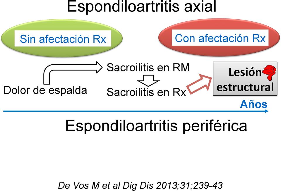 Sacroilitis en Rx Lesión estructural Años