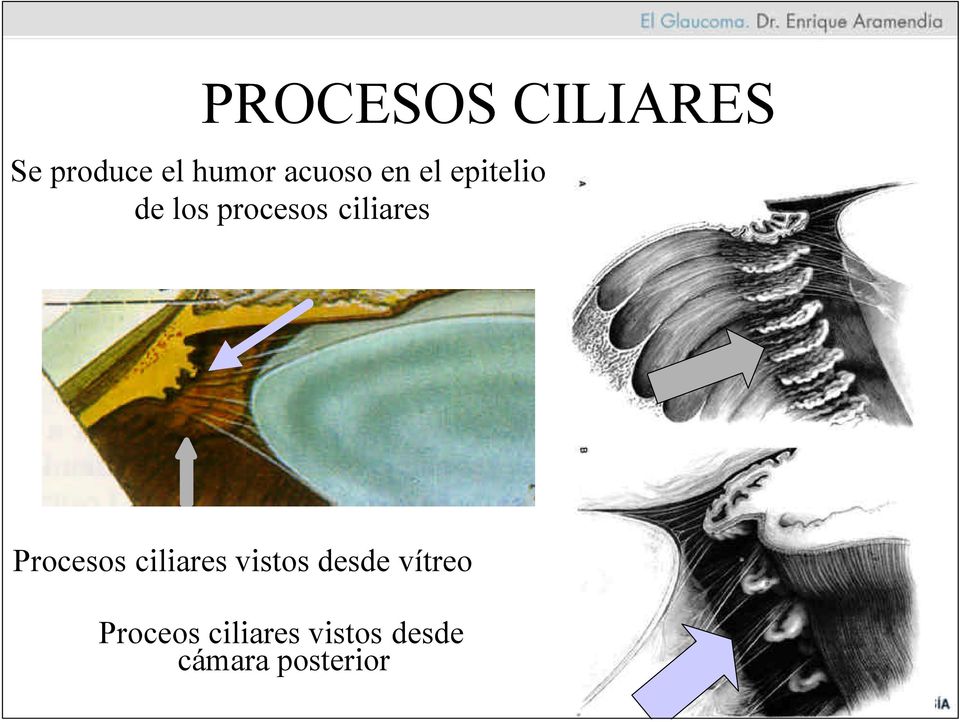 ciliares Procesos ciliares vistos desde
