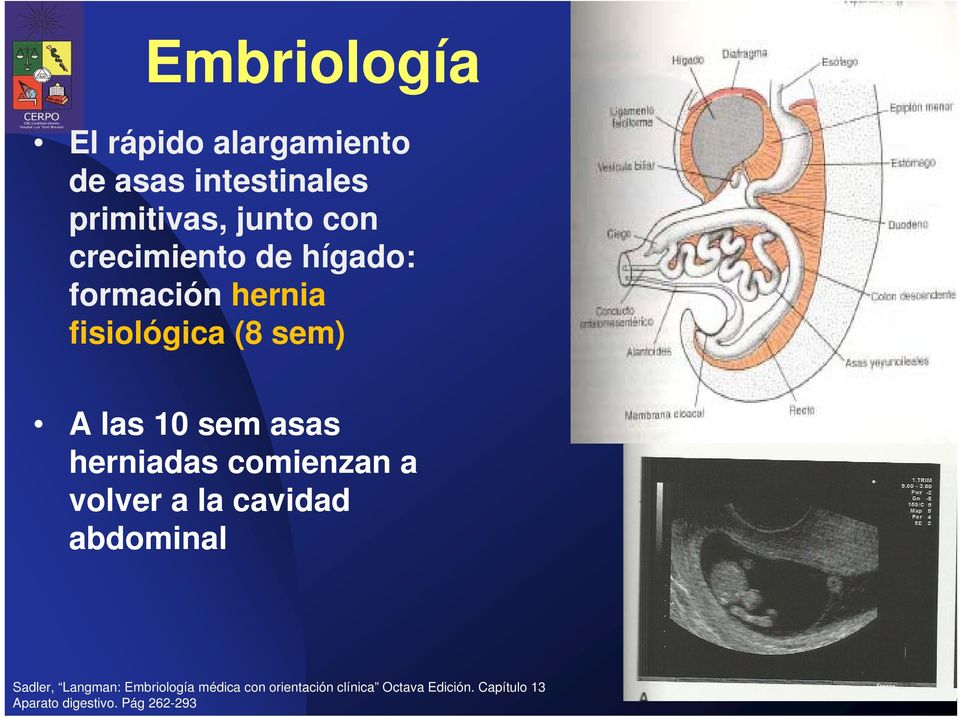 herniadas comienzan a volver a la cavidad abdominal Sadler, Langman: Embriología