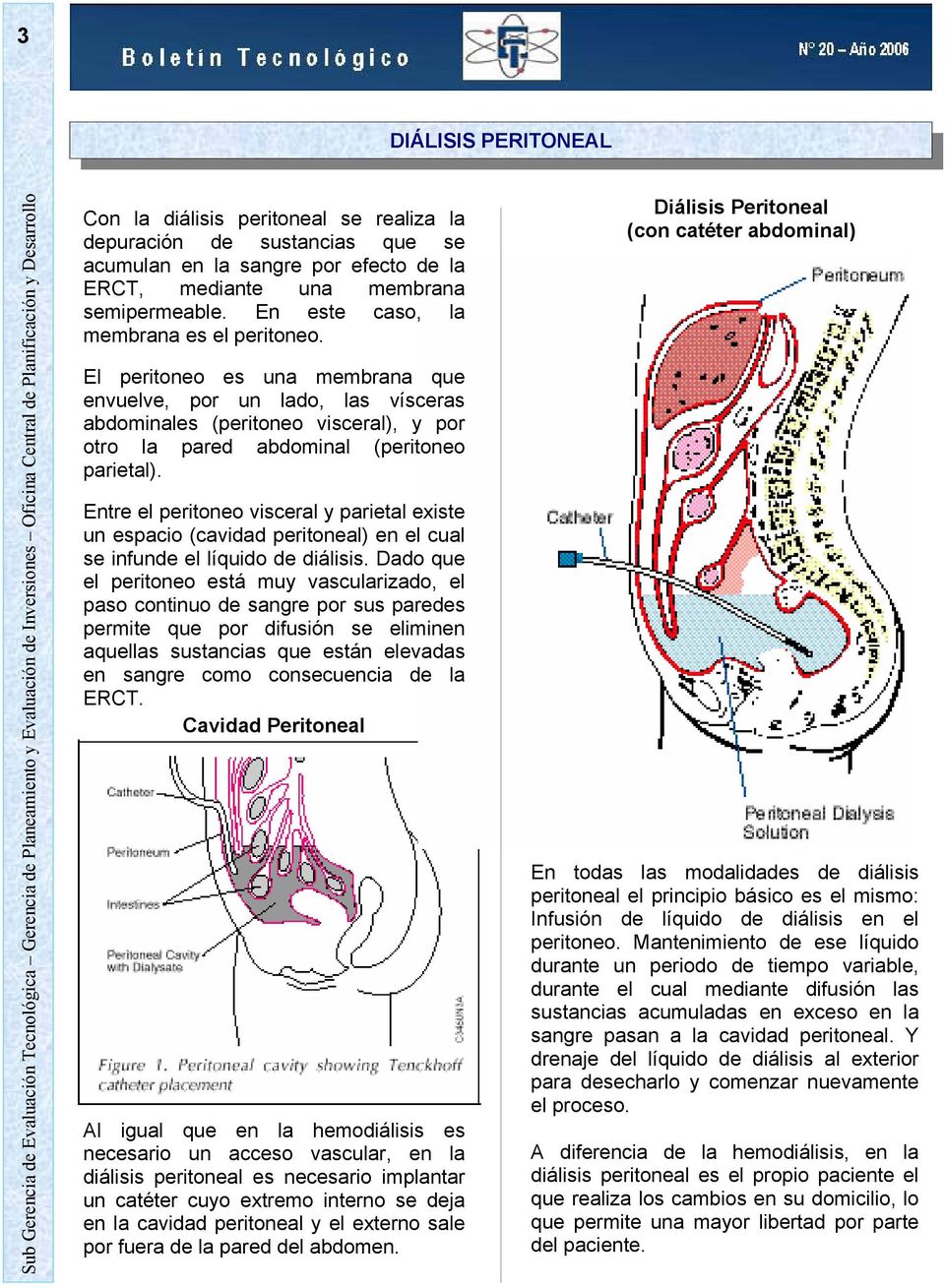 Entre el peritoneo visceral y parietal existe un espacio (cavidad peritoneal) en el cual se infunde el líquido de diálisis.