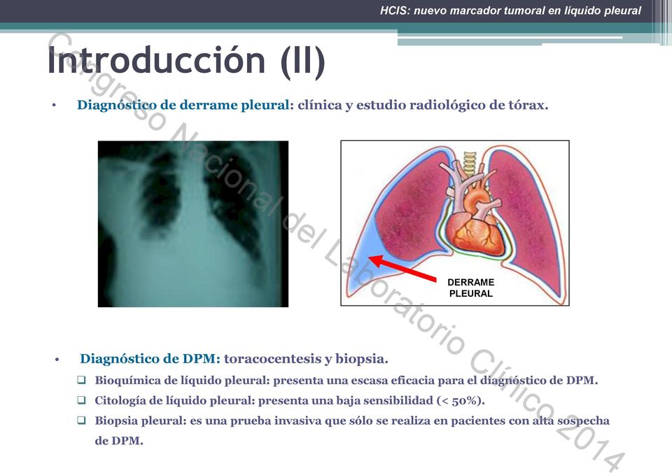 Bioquímica de líquido pleural: presenta una escasa eficacia para el diagnóstico de DPM.