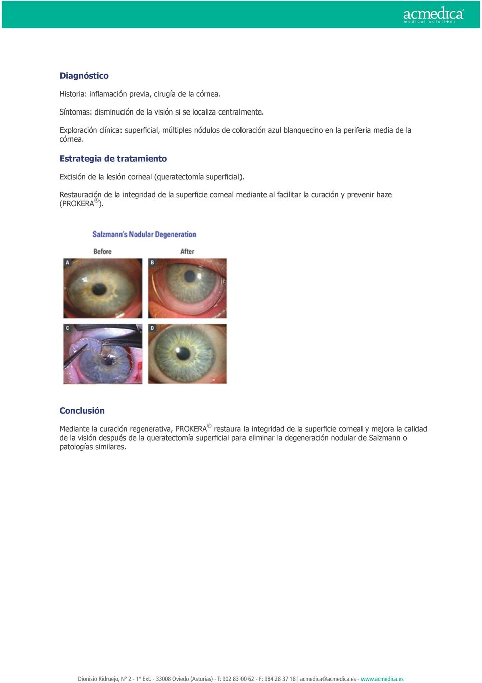 Estrategia de tratamiento Excisión de la lesión corneal (queratectomía superficial).