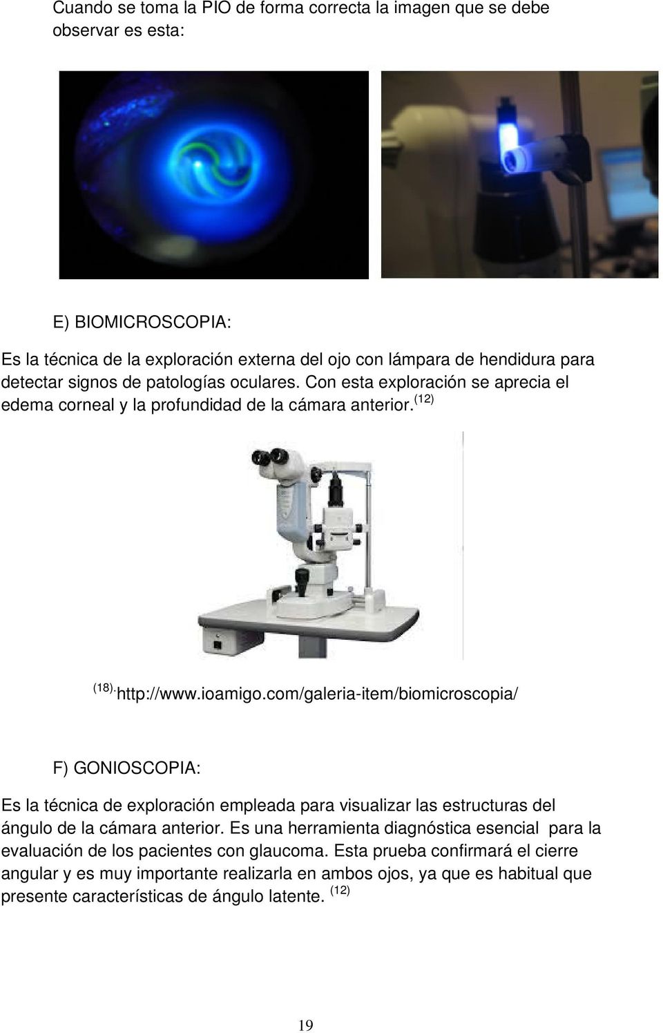 com/galeria-item/biomicroscopia/ F) GONIOSCOPIA: Es la técnica de exploración empleada para visualizar las estructuras del ángulo de la cámara anterior.