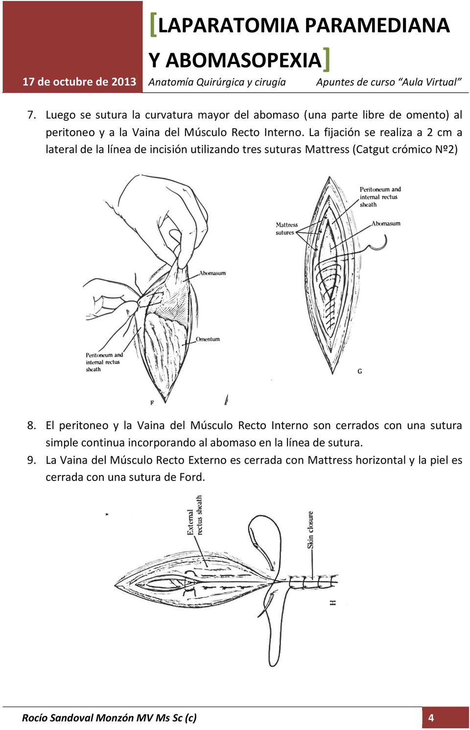 El peritoneo y la Vaina del Músculo Recto Interno son cerrados con una sutura simple continua incorporando al abomaso en la línea de