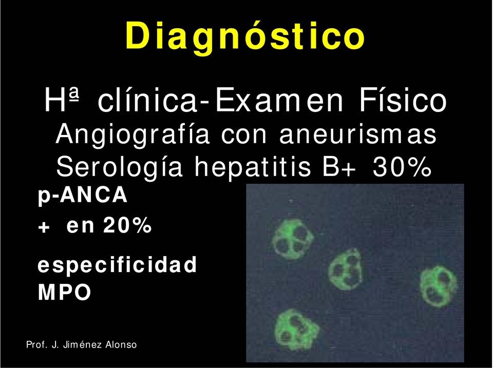 aneurismas Serología hepatitis