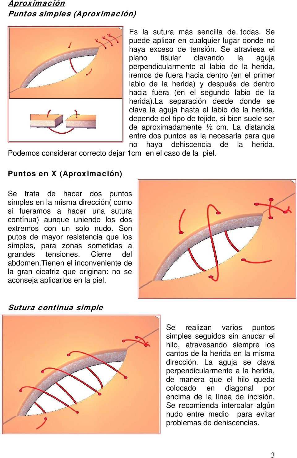 labio de la herida).la separación desde donde se clava la aguja hasta el labio de la herida, depende del tipo de tejido, si bien suele ser de aproximadamente ½ cm.