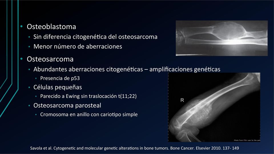Parecido a Ewing sin traslocación t(11;22) Osteosarcoma parosteal Cromosoma en anillo con cariojpo