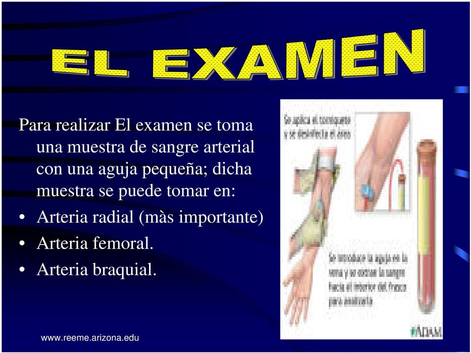 muestra se puede tomar en: Arteria radial (màs
