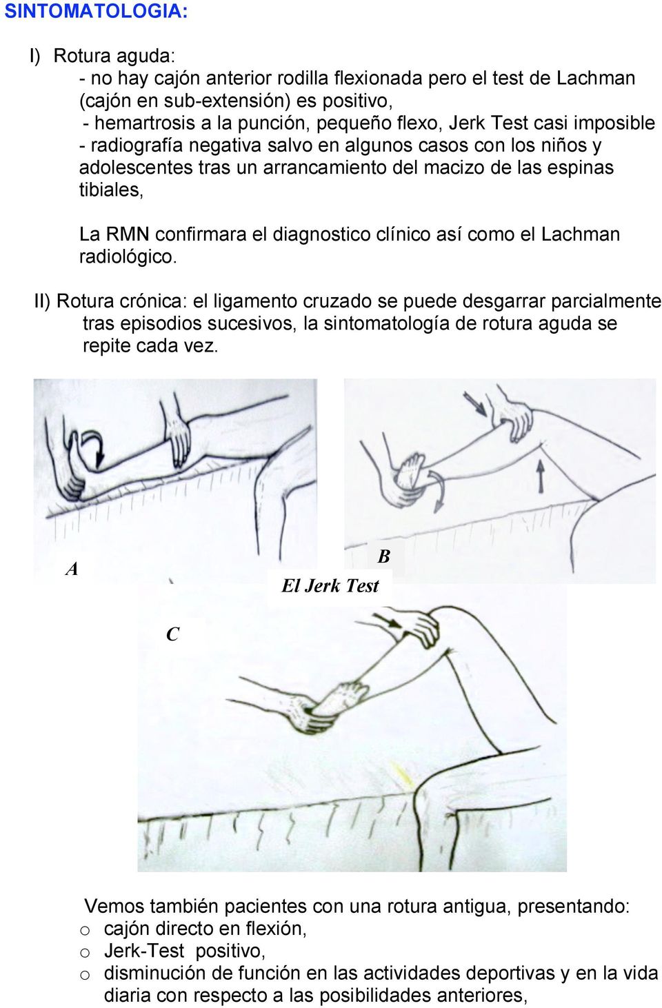 Lachman radiológico. II) Rotura crónica: el ligamento cruzado se puede desgarrar parcialmente tras episodios sucesivos, la sintomatología de rotura aguda se repite cada vez.