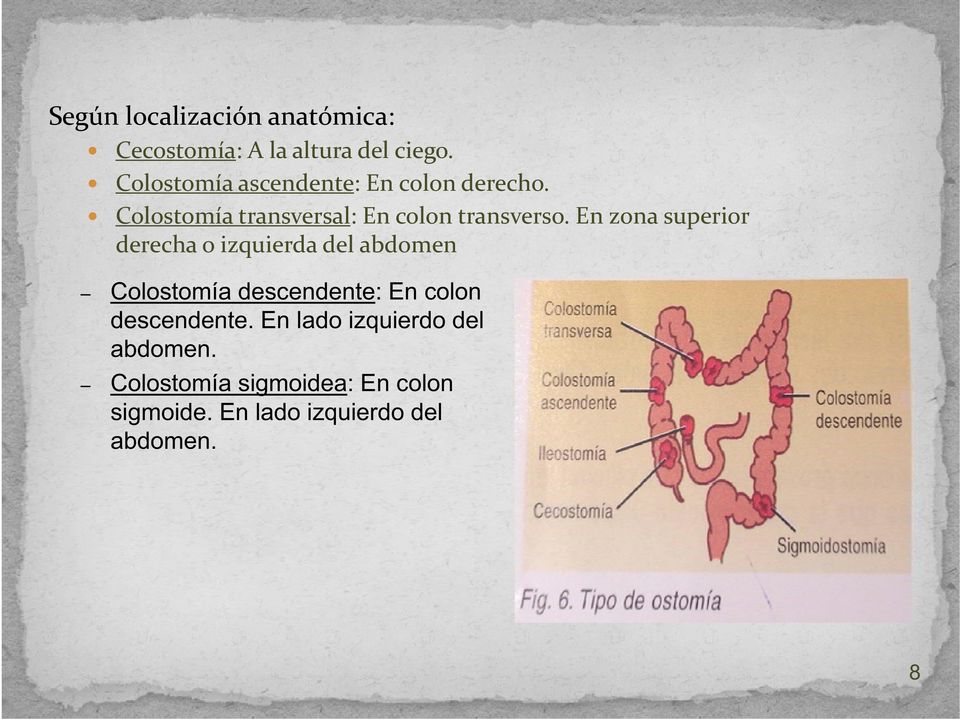 En zona superior d derecha o izquierda del abdomen h i i d d l bd Colostomía descendente: En
