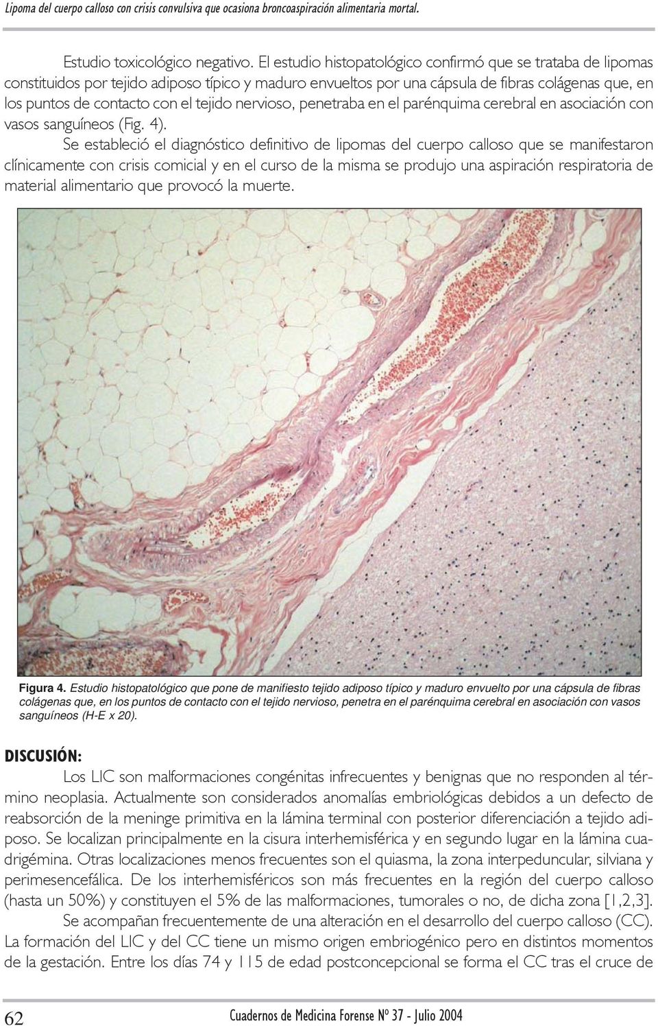 tejido nervioso, penetraba en el parénquima cerebral en asociación con vasos sanguíneos (Fig. 4).