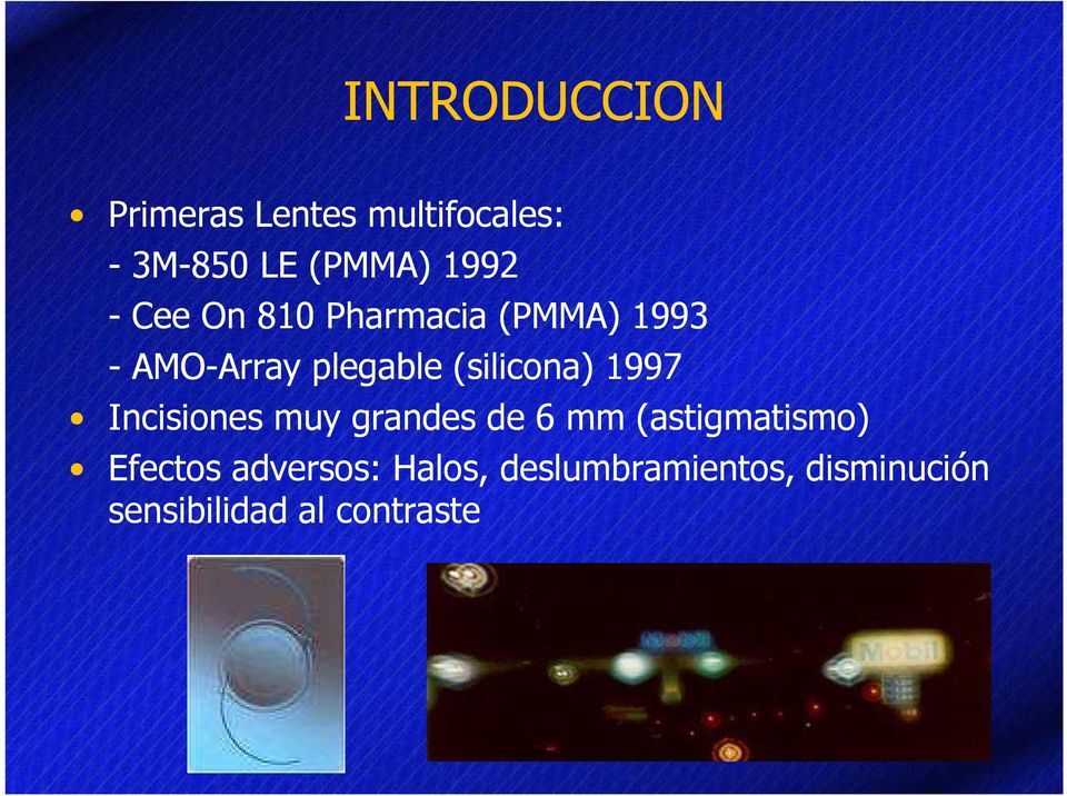 (silicona) 1997 Incisiones muy grandes de 6 mm (astigmatismo)