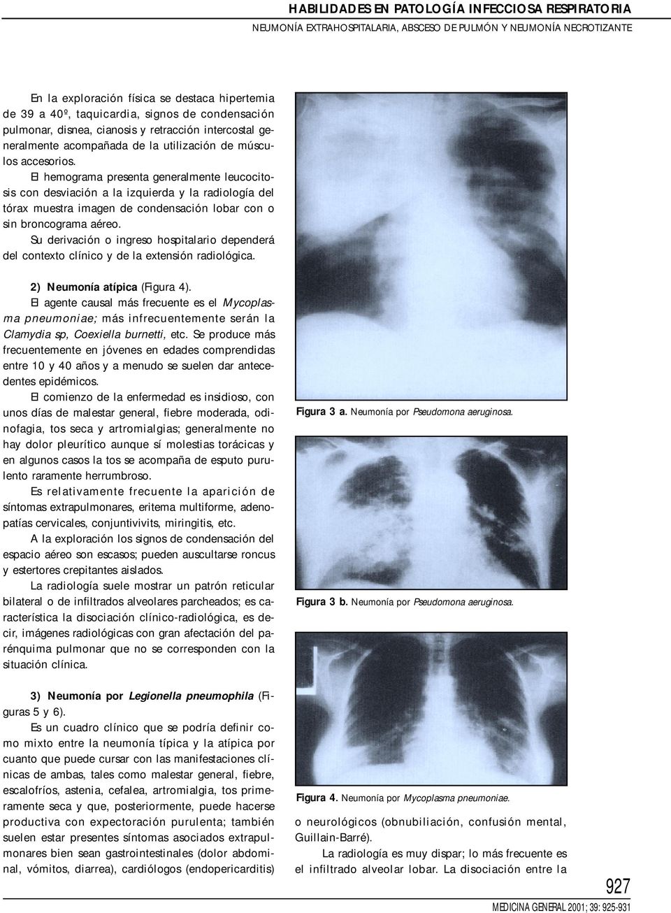 El hemograma presenta generalmente leucocitosis con desviación a la izquierda y la radiología del tórax muestra imagen de condensación lobar con o sin broncograma aéreo.