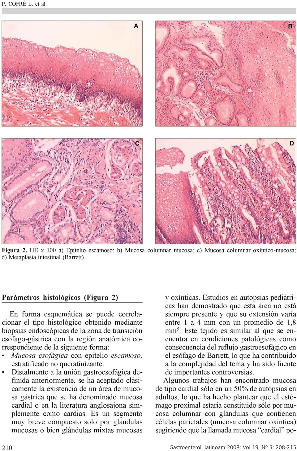 anatómica correspondiente de la siguiente forma: Mucosa esofágica con epitelio escamoso, estratificado no queratinizante.