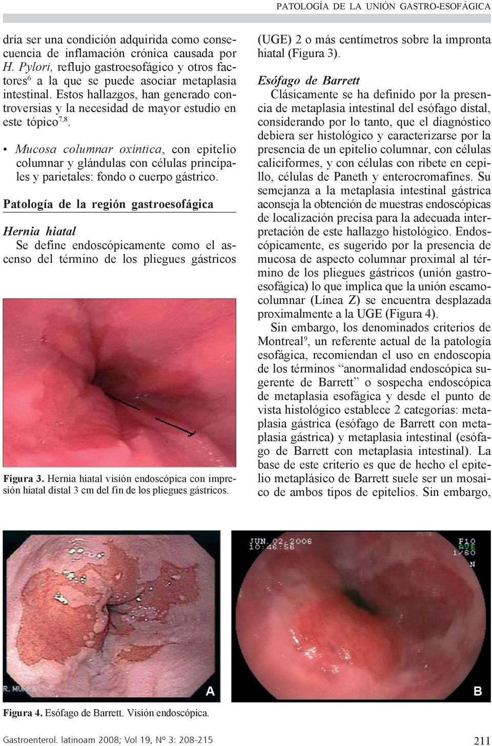 Mucosa columnar oxíntica, con epitelio columnar y glándulas con células principales y parietales: fondo o cuerpo gástrico.